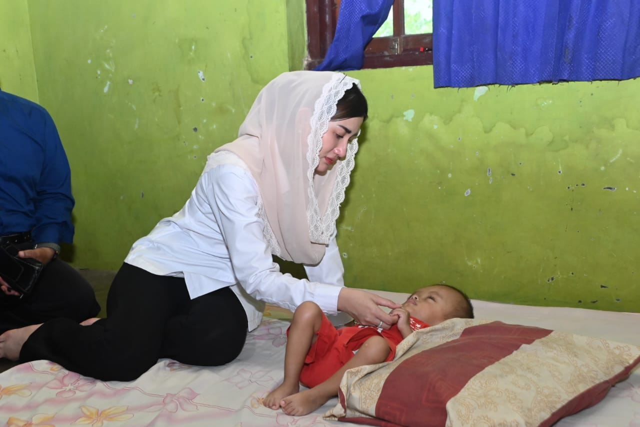 Kunjungi Balita Penderita Hidrosefalus, Novita Hardini Dorong Penguatan Peran PKK dan Posyandu